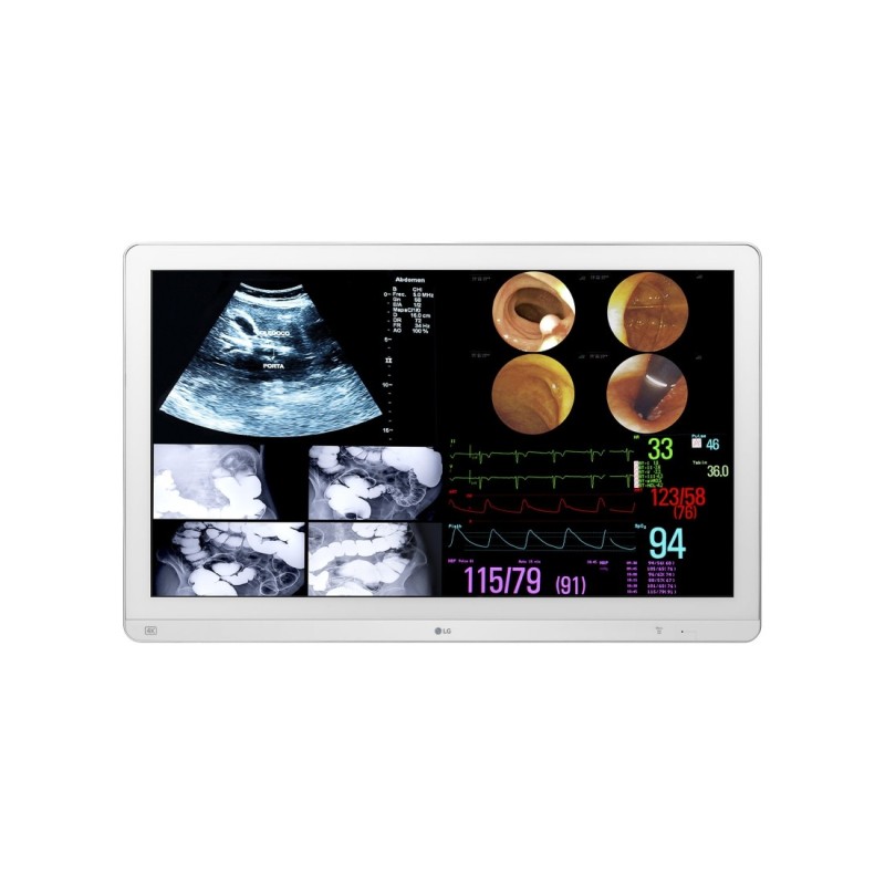 LG 32HL714S-W écran plat de PC 80 cm (31.5") 3840 x 2160 pixels 4K Ultra HD Blanc LG 32HL714S-W écran plat de PC 80 cm (31.5") 3840 x 2160 pixels 4K Ultra HD Blanc