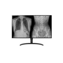 LG 32HL512D-M écran plat de PC 80 cm (31.5") 3840 x 2160 pixels Full HD Noir