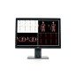 Barco MDCC-6530 écran plat de PC 77,2 cm (30.4") 3280 x 2048 pixels 4K Ultra HD Noir, Blanc Barco MDCC-6530 écran plat de PC 77,2 cm (30.4") 3280 x 2048 pixels 4K Ultra HD Noir, Blanc